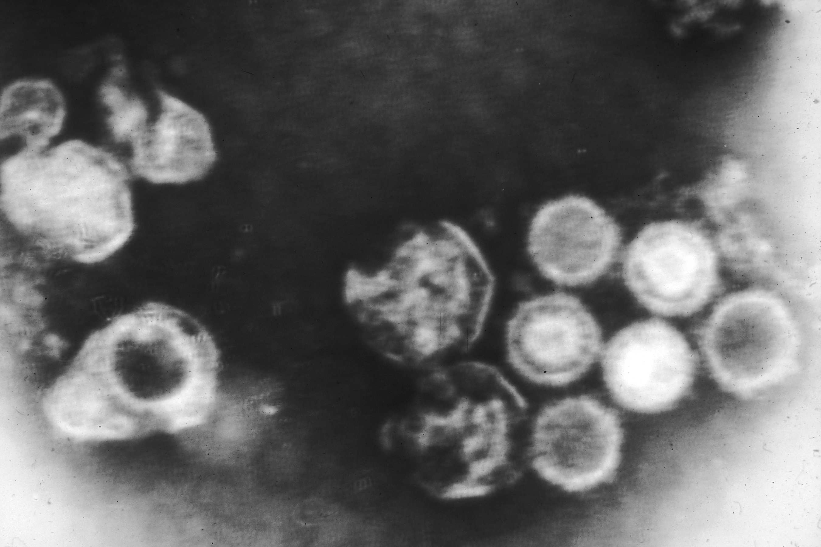 Electron Micrograph Of Epstein Barr Virus Biology Of Human World Of 