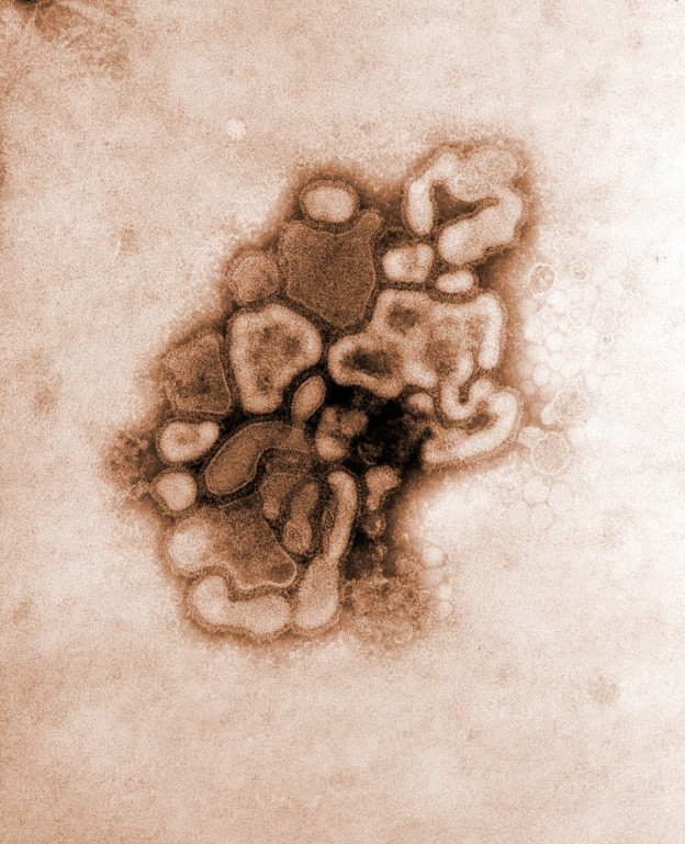 Electron Micrograph Of H1n1 Influenza Virus Biology Of Human World Of