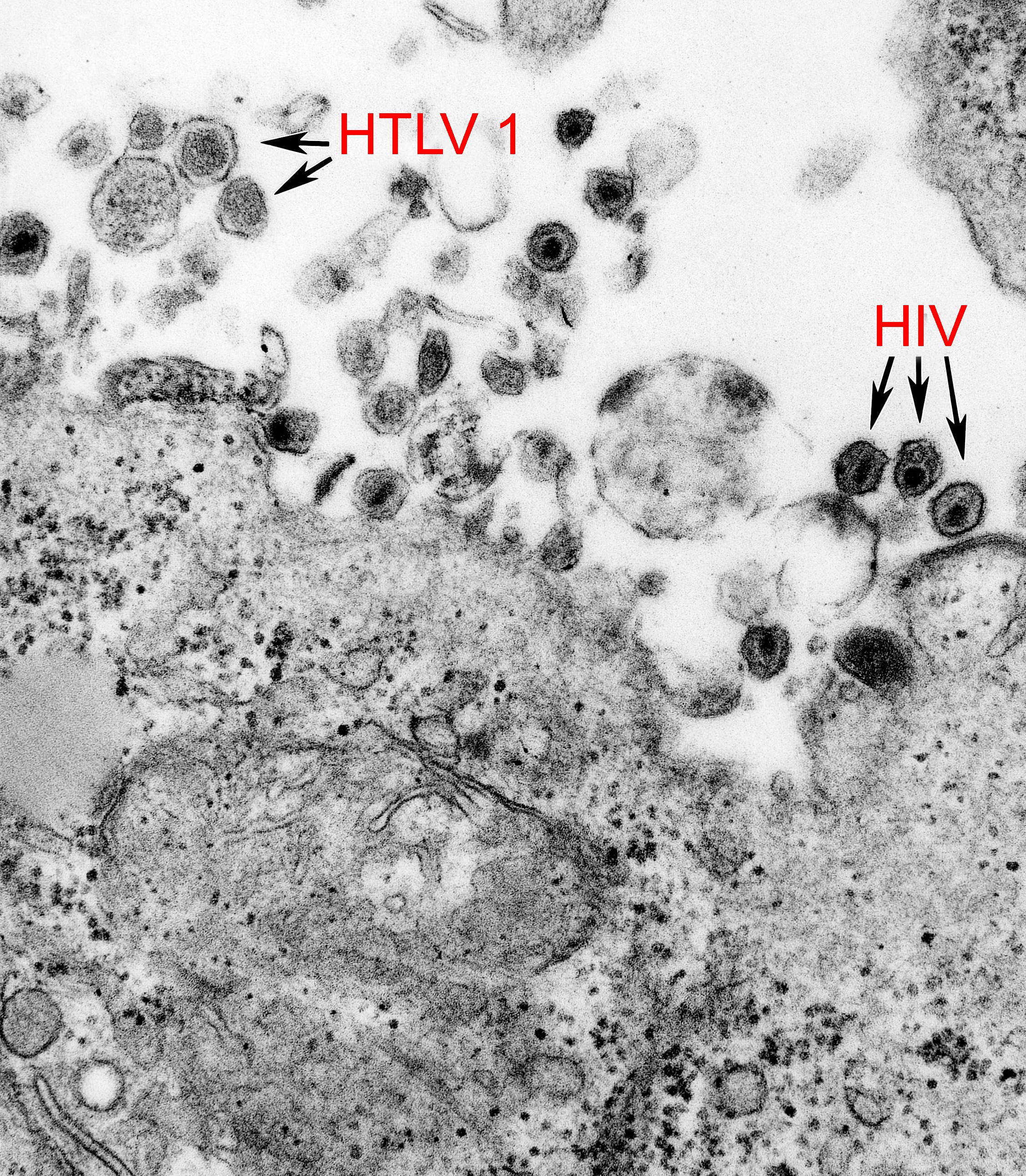 Electron Micrograph Of Htlv 1 And Hiv Biology Of Human World Of Viruses