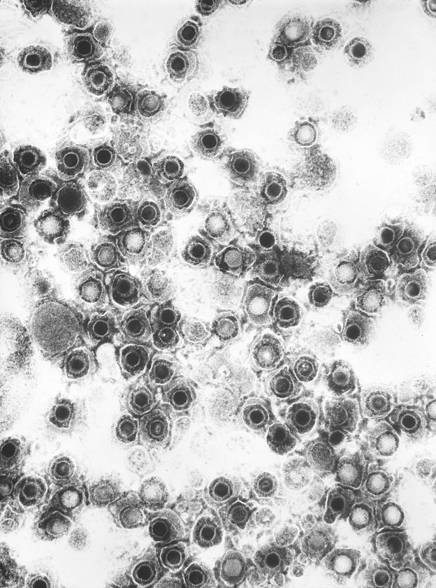 Electron micrograph of Coxsackie virus | Biology of Human/World of Viruses